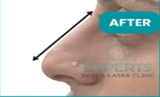 after-image