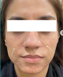 after-image
